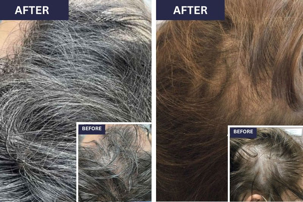 Scalp Treatments