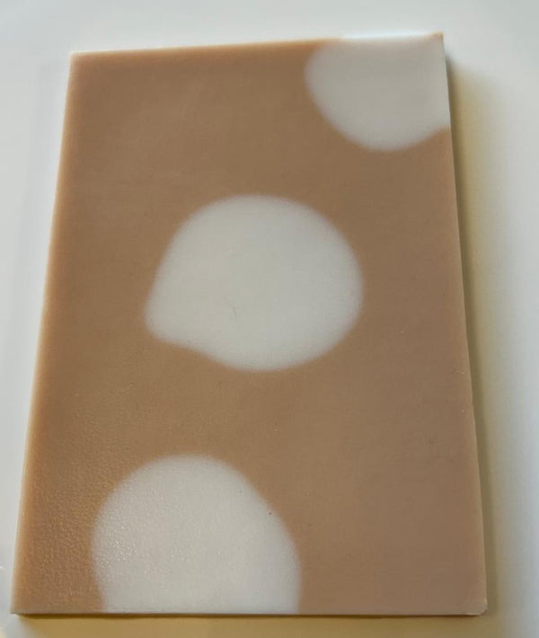 Vitiligo Practice Skin